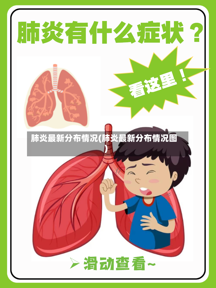 肺炎最新分布情况(肺炎最新分布情况图)