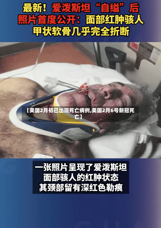 【美国2月初已出现死亡病例,美国2月6号新冠死亡】