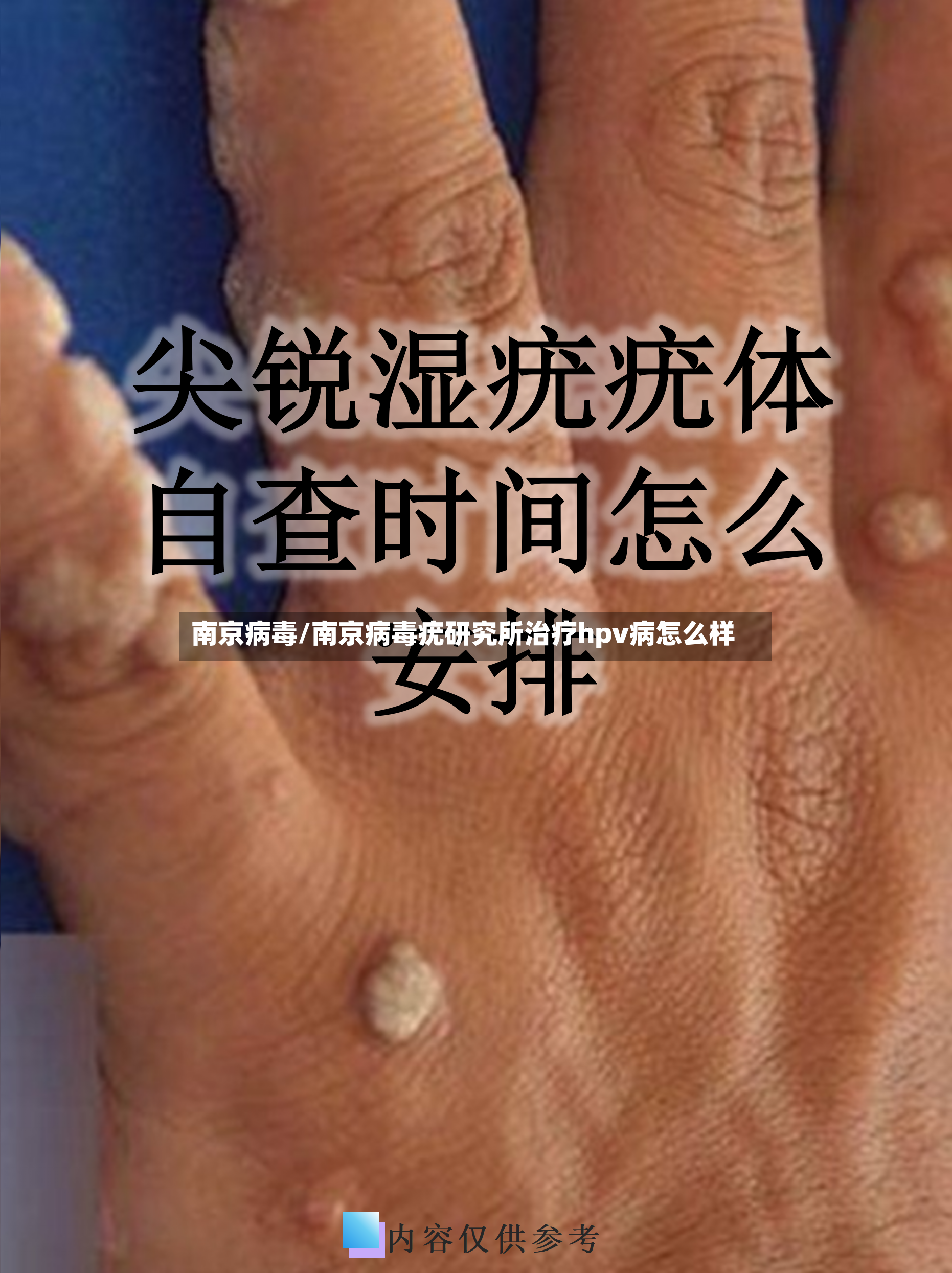 南京病毒/南京病毒疣研究所治疗hpv病怎么样