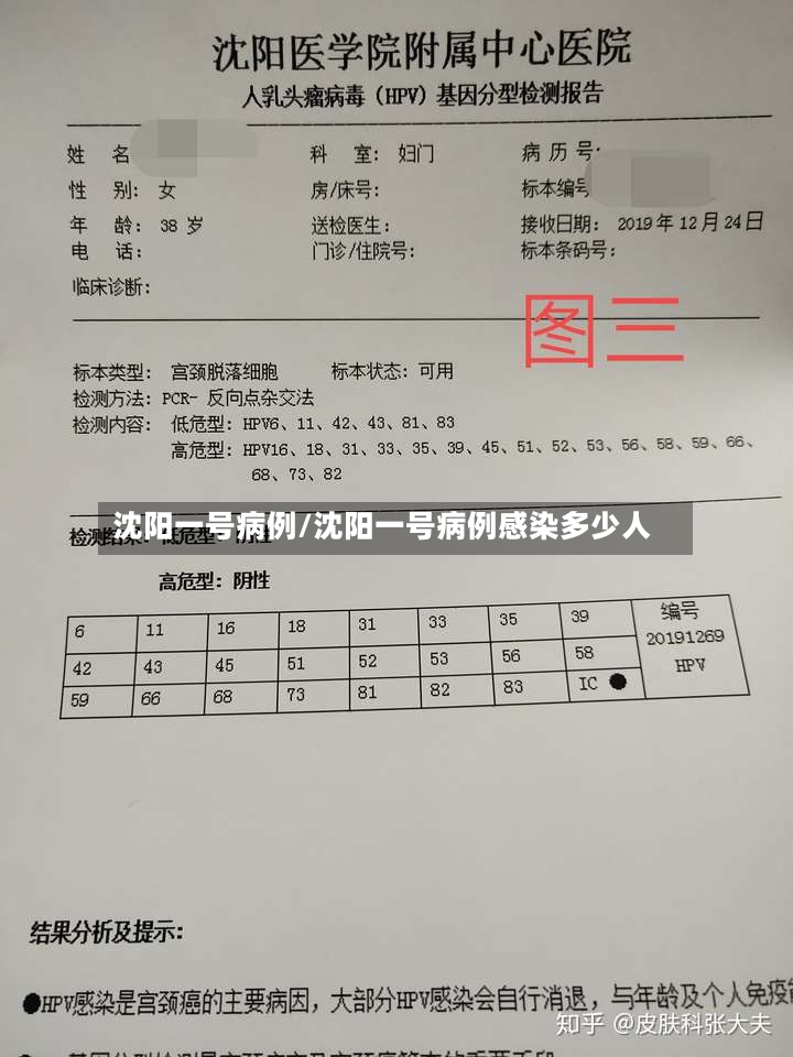 沈阳一号病例/沈阳一号病例感染多少人