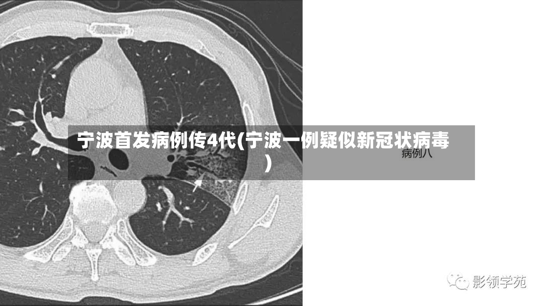 宁波首发病例传4代(宁波一例疑似新冠状病毒)