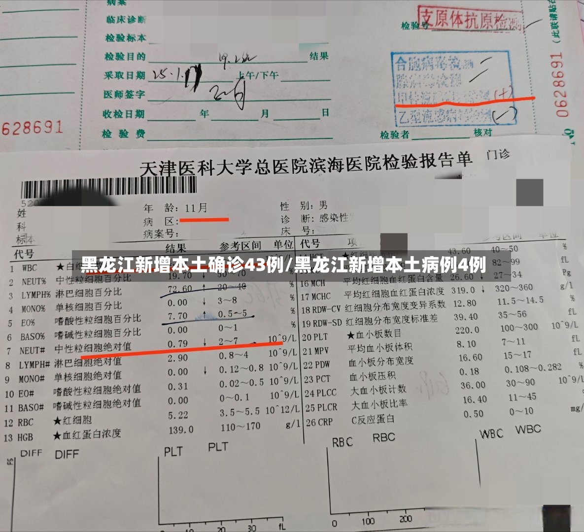 黑龙江新增本土确诊43例/黑龙江新增本土病例4例