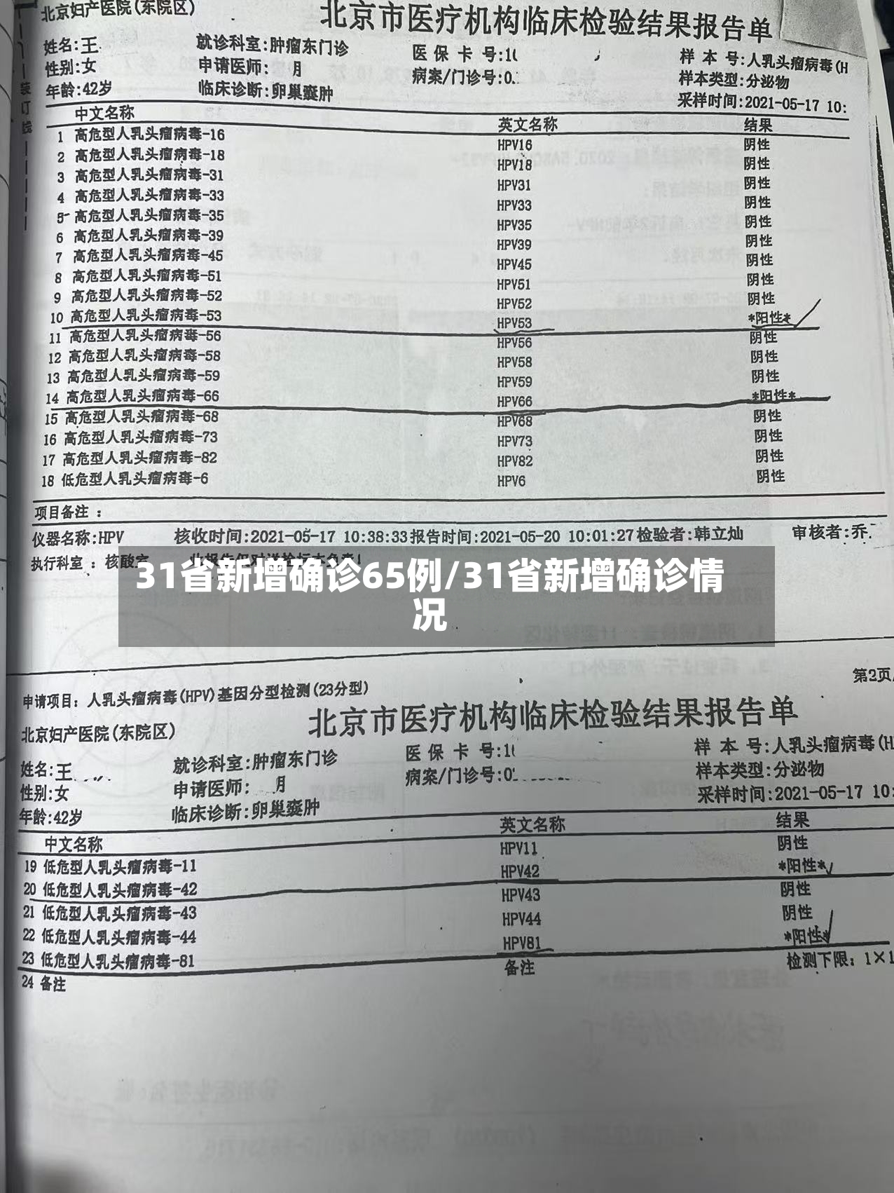 31省新增确诊65例/31省新增确诊情况