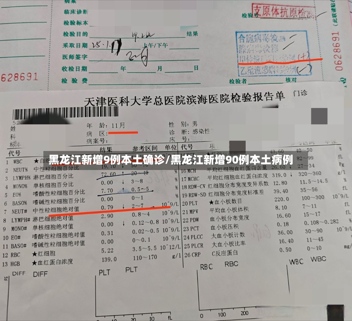 黑龙江新增9例本土确诊/黑龙江新增90例本土病例-第2张图片