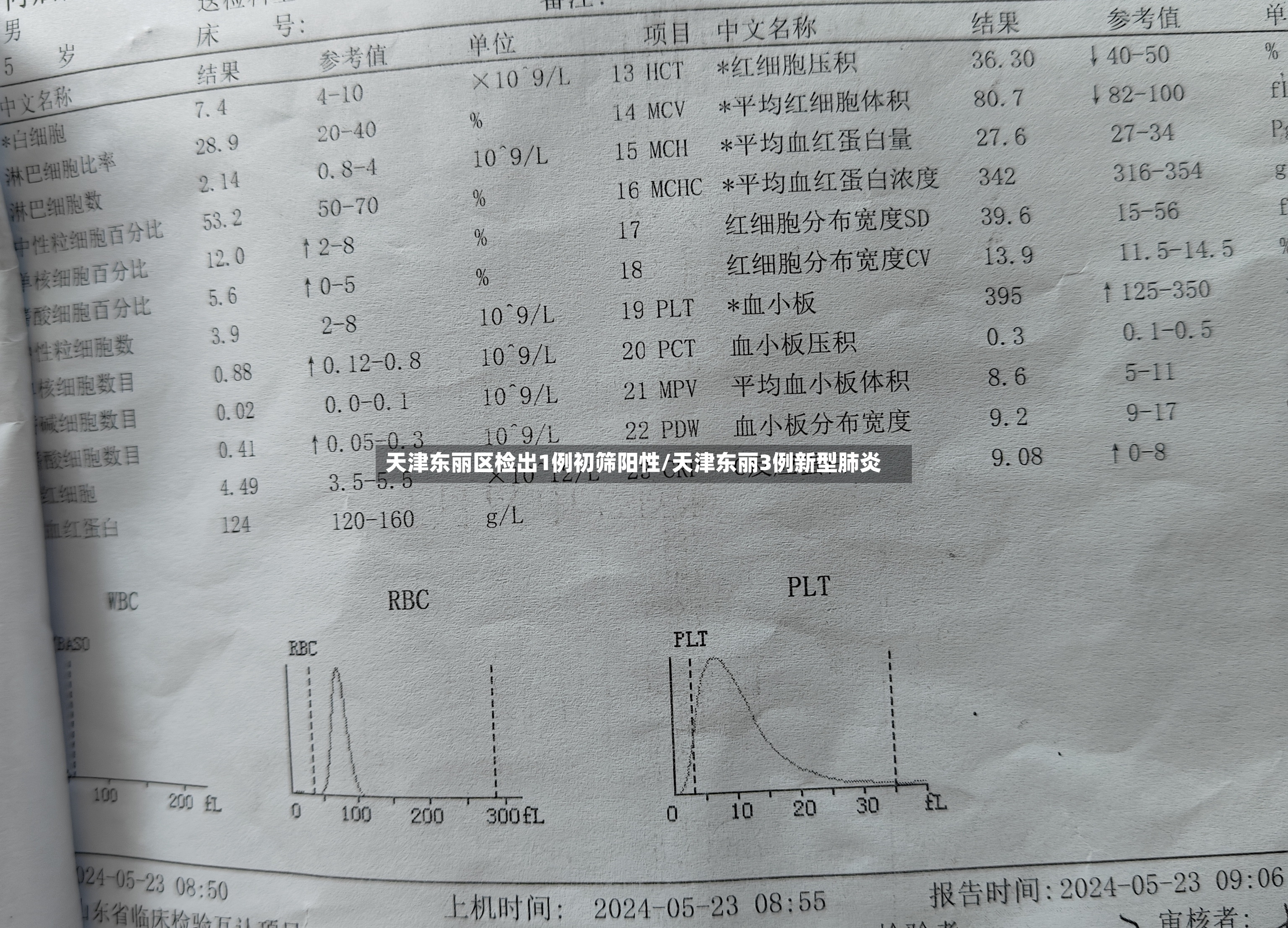 天津东丽区检出1例初筛阳性/天津东丽3例新型肺炎